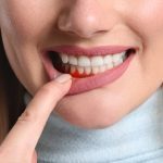 Tips to Prevent Periodontal Disease